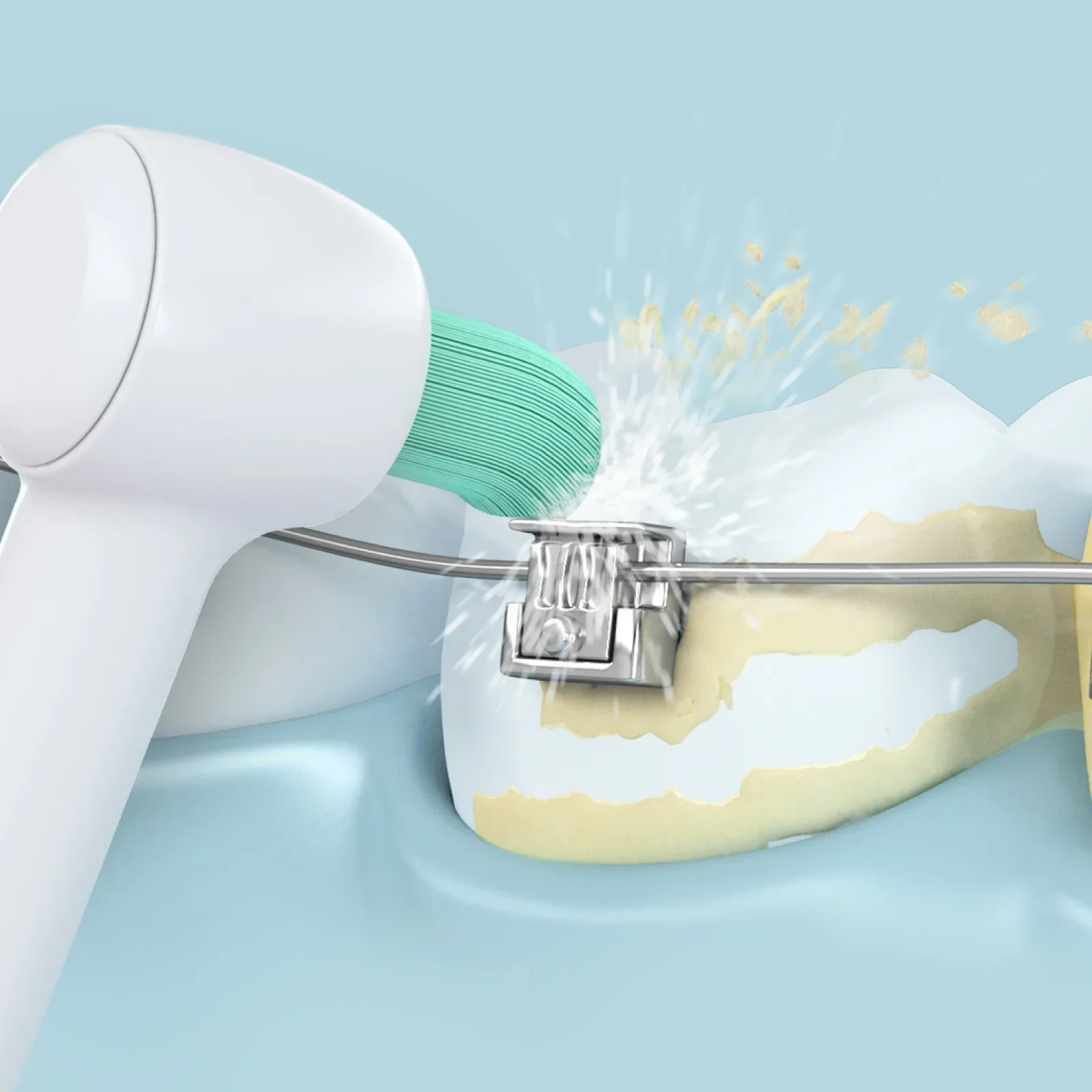 Cordless Water Flosser for Braces
